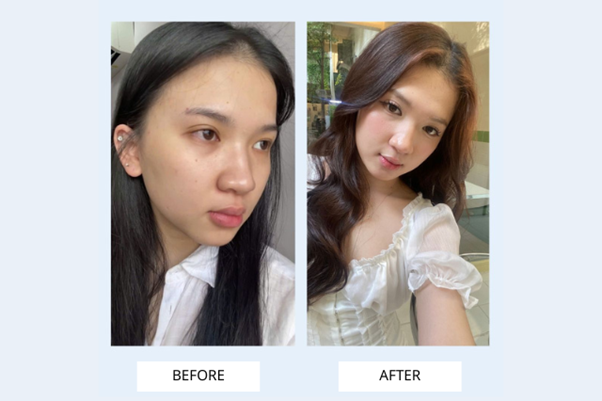 Thương hiệu skincare Hàn Quốc tập trung nghiên cứu cơ chế lỗ chân lông được nhiều tín đồ làm đẹp quan tâm- Ảnh 3. Thương hiệu skincare Hàn Quốc tập trung nghiên cứu cơ chế lỗ chân lông được nhiều tín đồ làm đẹp quan tâm- Ảnh 3.