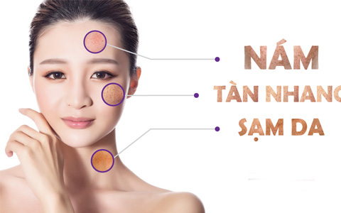 Vì sao vẫn sạm da dù ăn nhiều trái cây giàu vitamin C?- Ảnh 4. 5 bài thuốc chữa sạm da