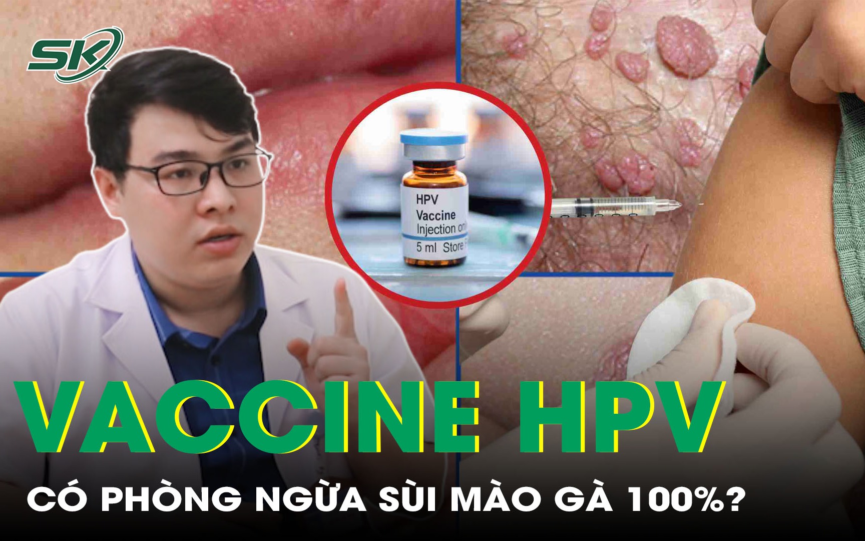 Tiêm vaccine HPV có giúp ngăn ngừa sùi mào gà triệt để hay không?
