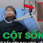 Đau lưng kéo dài nhưng chủ quan, người đàn ông bất ngờ liệt hai chân vì lao cột sống