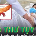 Người đàn ông 57 tuổi phát hiện ung thư tụy từ dấu hiệu ợ nóng