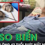 Người đàn ông 42 tuổi suýt mất mạng do ăn so biển