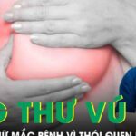 Nhiều phụ nữ mắc ung thư vú vì những thói quen phổ biến này