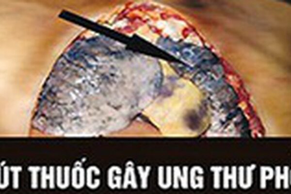 WHO: Cảnh báo trên bao bì thuốc lá là cách truyền thông hiệu quả, ít tốn kém