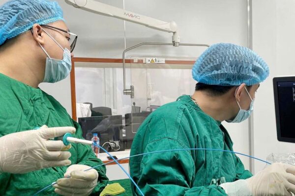 Nuốt nhầm tăm tre, người đàn ông suýt phải phẫu thuật vì áp xe gan